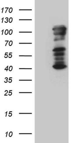 TBX3 Monoclonal Antibody (OTI7C4), TrueMAB , OriGene 100 &mu;L; Unconjugated:Antibodies,