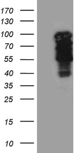 TBX3 Monoclonal Antibody (OTI8H5), TrueMAB , OriGene 100 &mu;L; Unconjugated:Antibodies,