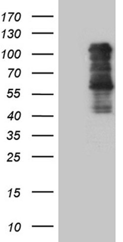 TBX3 Mouse anti-Human, Clone: OTI8G5, lyophilized, TrueMAB 100 &mu;g; Unconjugated:Antibodies,