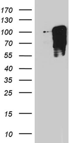 TBX3 Monoclonal Antibody (OTI3B1), TrueMAB , OriGene:Antibodies:Primary