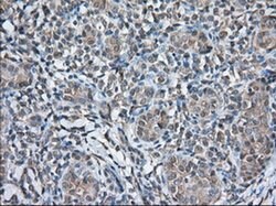 TBXAS Monoclonal Antibody (OTI1H9), TrueMAB , OriGene 30 &mu;L; Unconjugated:Antibodies,