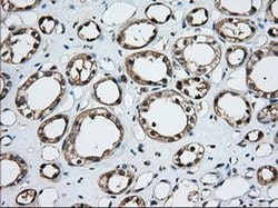 TBXAS Monoclonal Antibody (OTI1H9), TrueMAB , OriGene 30 &mu;L; Unconjugated:Antibodies,