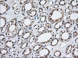 TBXAS Monoclonal Antibody (OTI1C3), TrueMAB , OriGene 30 &mu;L; Unconjugated:Antibodies,