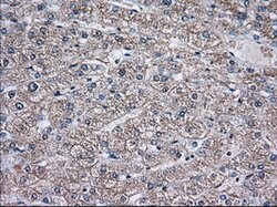 TBXAS Mouse anti-Human, Clone: OTI1C3, lyophilized, TrueMAB 100 &mu;g;