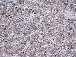 TBXAS Monoclonal Antibody (OTI1C3), TrueMAB , OriGene 30 &mu;L; Unconjugated:Antibodies,