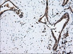 TBXAS Monoclonal Antibody (OTI1H1), TrueMAB , OriGene 100 &mu;L; Unconjugated:Antibodies,