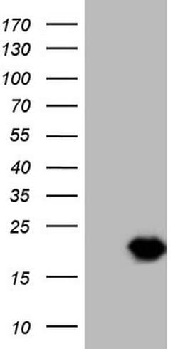 TCAP Monoclonal Antibody (OTI6C1), TrueMAB , OriGene 100 &mu;L | Buy Online | OriGene | Fisher Scientific