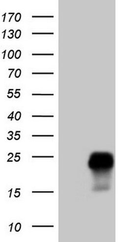 TCAP Monoclonal Antibody (OTI8E6), TrueMAB , OriGene 100 &mu;L; Unconjugated:Antibodies,