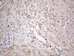 TCEAL1 Monoclonal Antibody (OTI1B1), TrueMAB , OriGene 100 &mu;L | Buy Online | Origene Technologies | Fisher Scientific