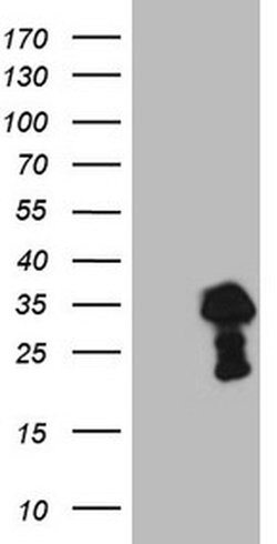 TCEAL1 Monoclonal Antibody (OTI4C6), TrueMAB , OriGene 30 &mu;L | Buy Online | Origene Technologies | Fisher Scientific