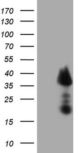 TCEAL1 Monoclonal Antibody (OTI2A1), TrueMAB , OriGene:Antibodies:Primary