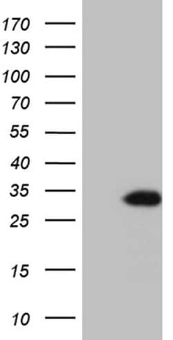 TCEANC2 Monoclonal Antibody (OTI2B11), TrueMAB , OriGene 100 &mu;L; Unconjugated:Antibodies,