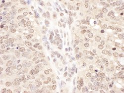 TCEB2 Rabbit anti-Human, Mouse, Polyclonal, Bethyl Laboratories 10 &mu;L;