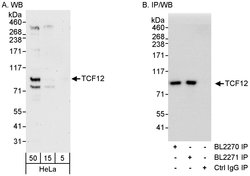 TCF12 Rabbit anti-Human, Polyclonal, Bethyl Laboratories 100 &mu;l; Unlabeled:Antibodies,
