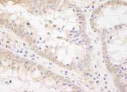 TCF12 Polyclonal Antibody, Bethyl Laboratories:Antibodies:Primary Antibodies