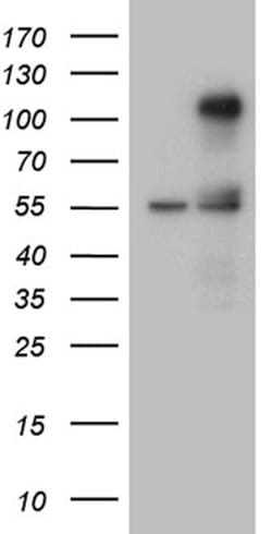 TCF12 Mouse anti-Human, Clone: OTI4B5, lyophilized, TrueMAB 100 &mu;g;