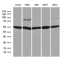 TCF12 Mouse anti-Human, Clone: OTI4B5, lyophilized, TrueMAB 100 &mu;g;