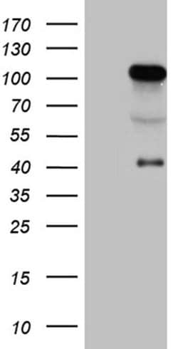TCF12 Monoclonal Antibody (OTI4A7), TrueMAB , OriGene 100 &mu;L; Unconjugated:Antibodies,