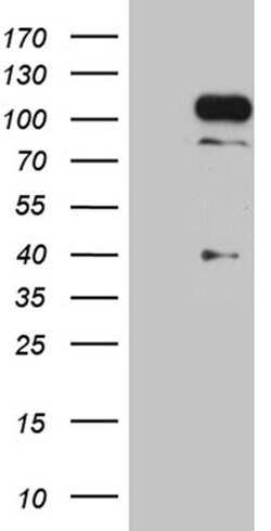 TCF12 Monoclonal Antibody (OTI3C11), TrueMAB , OriGene 100 &mu;L; Unconjugated:Antibodies,