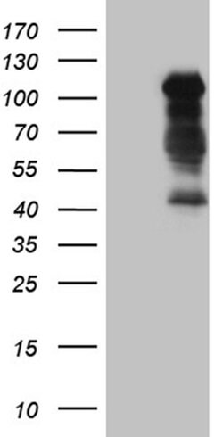 TCF12 Monoclonal Antibody (OTI2E11), TrueMAB , OriGene:Antibodies:Primary