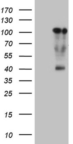 TCF12 Monoclonal Antibody (OTI1F11), TrueMAB , OriGene:Antibodies:Primary