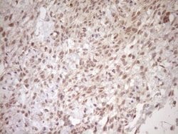 TCP10 Monoclonal Antibody (OTI2C2), TrueMAB , OriGene 100 &mu;L; Unconjugated:Antibodies,