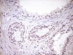 TCP10 Monoclonal Antibody (OTI2C2), TrueMAB , OriGene 100 &mu;L; Unconjugated:Antibodies,