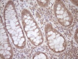 TCP10 Monoclonal Antibody (OTI2C2), TrueMAB , OriGene:Antibodies:Primary