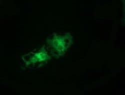 TCP11L2 Monoclonal Antibody (OTI3E4), TrueMAB , OriGene 100 &mu;L; Unconjugated:Antibodies,
