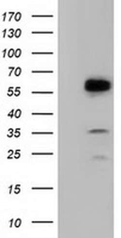 TCP11L2 Monoclonal Antibody (OTI1F4), TrueMAB , OriGene:Antibodies:Primary