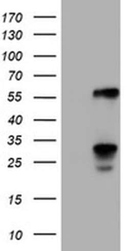 TCP11L2 Monoclonal Antibody (OTI2H4), TrueMAB , OriGene 30 &mu;L; Unconjugated:Antibodies,