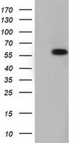TCP11L2 Monoclonal Antibody (OTI3H7), TrueMAB , OriGene:Antibodies:Primary