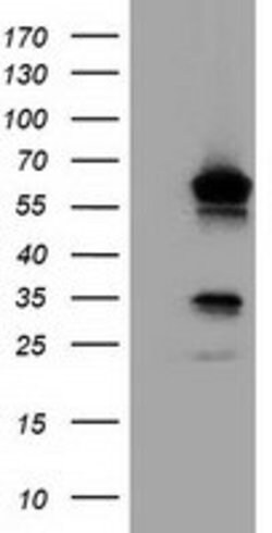 TCP11L2 Mouse anti-Human, Clone: OTI1G3, lyophilized, TrueMAB 100 &mu;g;