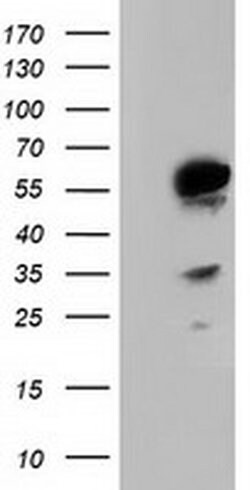 TCP11L2 Monoclonal Antibody (OTI1H7), TrueMAB , OriGene 100 &mu;L; Unconjugated:Antibodies,