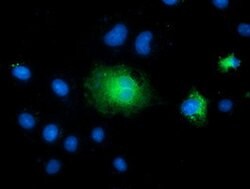 TCTN2 Mouse anti-Human, Clone: OTI1C1, lyophilized, TrueMAB 100 &mu;g;