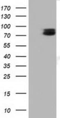TCTN2 Mouse anti-Human, Clone: OTI1C1, lyophilized, TrueMAB 100 &mu;g;