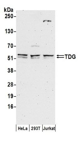 TDG Rabbit anti-Human, Polyclonal, Bethyl Laboratories 100 &mu;L; Unconjugated:Antibodies,
