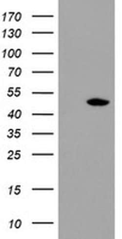 TDO2 Monoclonal Antibody (OTI1B1), TrueMAB , OriGene 100 &mu;L; Unconjugated:Antibodies,