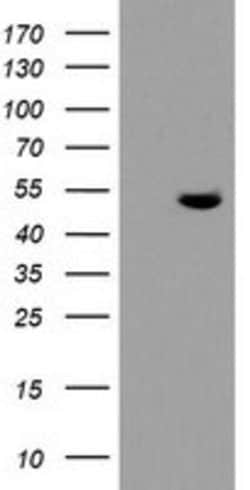 TDO2 Mouse anti-Human, Clone: OTI2A4, lyophilized, TrueMAB 100 &mu;g; Unconjugated:Antibodies,