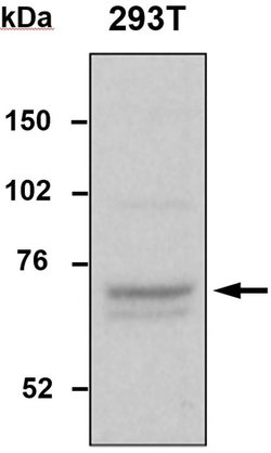 Invitrogen TDP1 Polyclonal Antibody 100 &mu;L; Unconjugated:Antibodies,