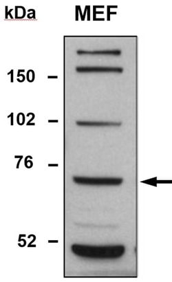 Invitrogen TDP1 Polyclonal Antibody 100 &mu;L; Unconjugated:Antibodies,