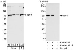 TDP1 Rabbit anti-Human, Polyclonal, Bethyl Laboratories 100 &mu;L; Unconjugated:Antibodies,