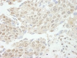 TDP1 Polyclonal Antibody, Bethyl Laboratories 10 &mu;L; Unconjugated:Antibodies,