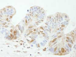 TDP1 Polyclonal Antibody, Bethyl Laboratories 10 &mu;L; Unconjugated:Antibodies,