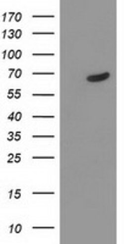 TDP1 Mouse anti-Human, Clone: OTI4H1, lyophilized, TrueMAB 100 &mu;g; Unconjugated:Antibodies,