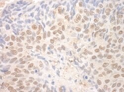 TDRD3 Polyclonal Antibody, Bethyl Laboratories 10 &mu;l; Unlabeled:Antibodies,