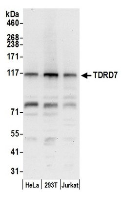 TDRD7 Rabbit anti-Human, Polyclonal, Bethyl Laboratories 100 &mu;L; Unconjugated:Antibodies,