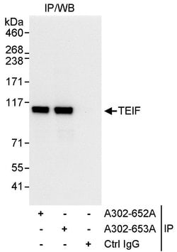 TEIF Rabbit anti-Human, Polyclonal, Bethyl Laboratories 10 &mu;L; Unconjugated:Antibodies,