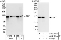 TEIF Rabbit anti-Human, Mouse, Polyclonal, Bethyl Laboratories 100 &mu;L;