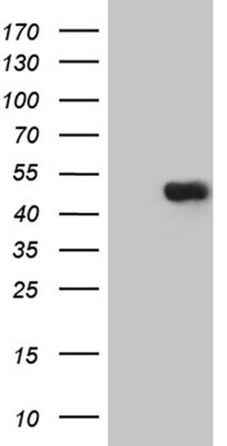 TEKT2 Monoclonal Antibody (OTI1E6), TrueMAB , OriGene:Antibodies:Primary